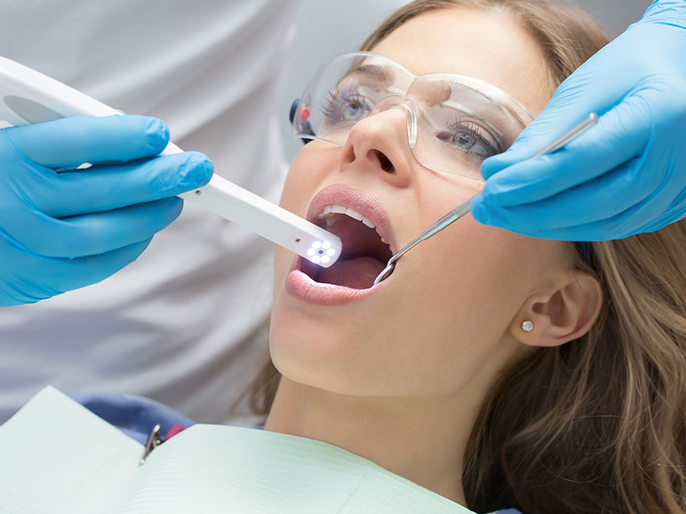 dental fillings in sherwood park