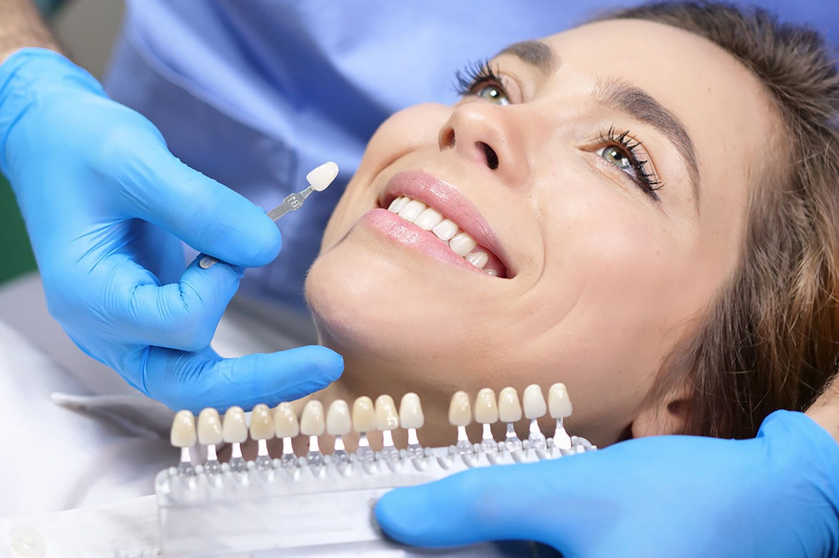 teeth whitening in sherwood park