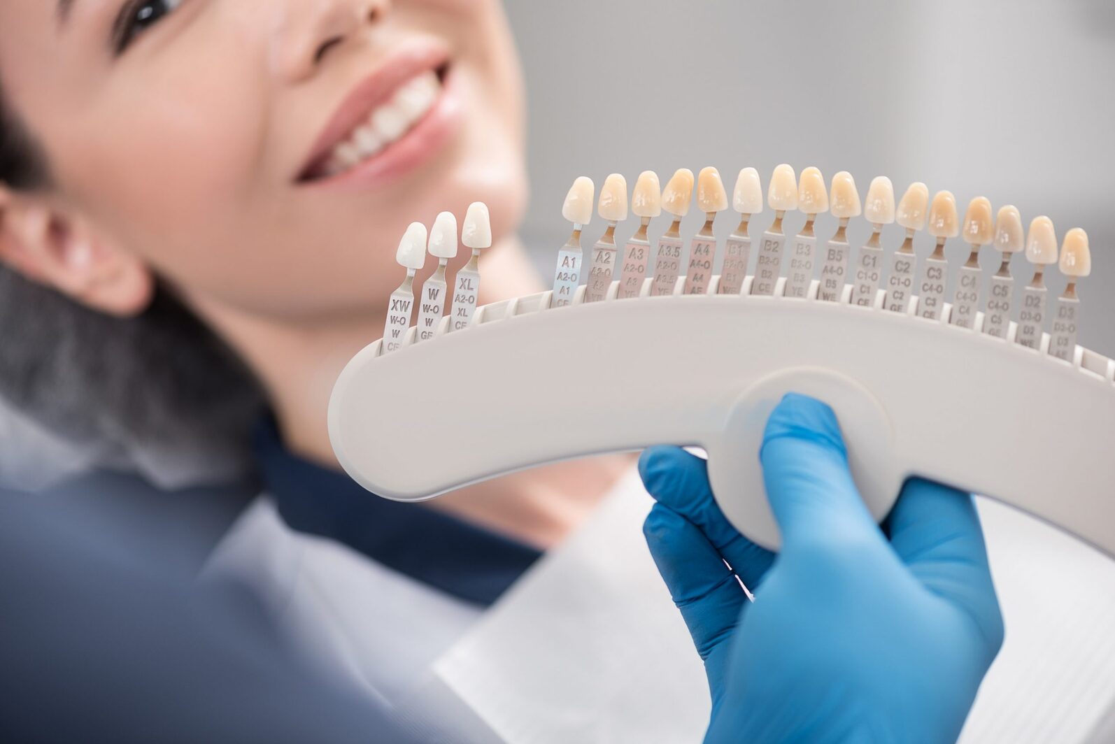 4 benefits of teeth whitening