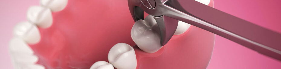 gums heal after a tooth extraction