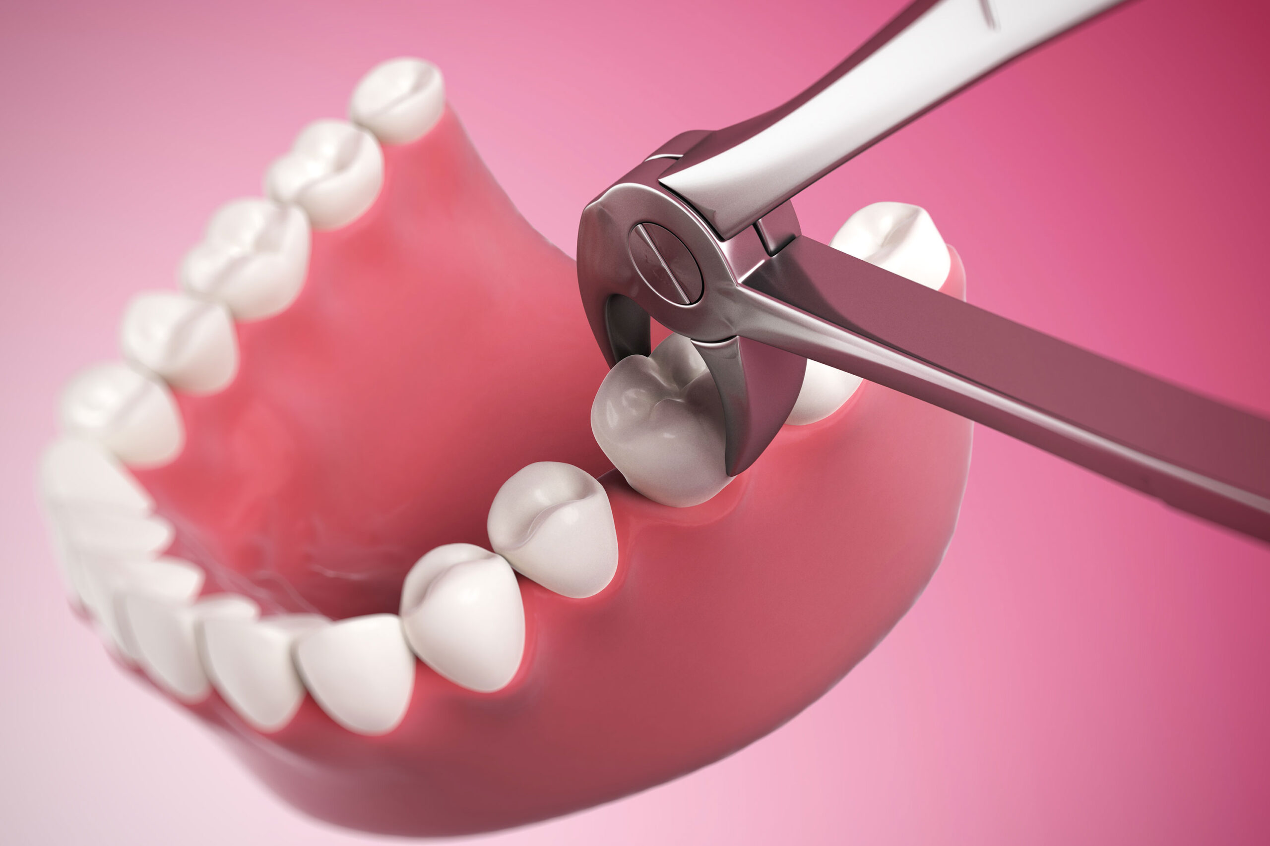 gums heal after a tooth extraction