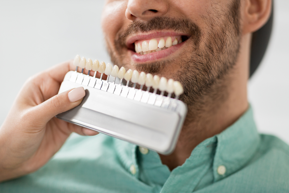 replacing dental veneers what you need to know
