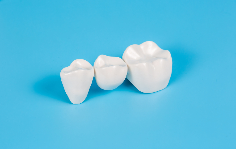 caring for your dental crown tips for longevity and maintenance