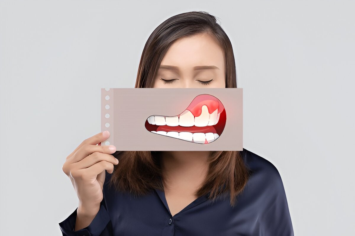 Dental Implants in Sherwood Park