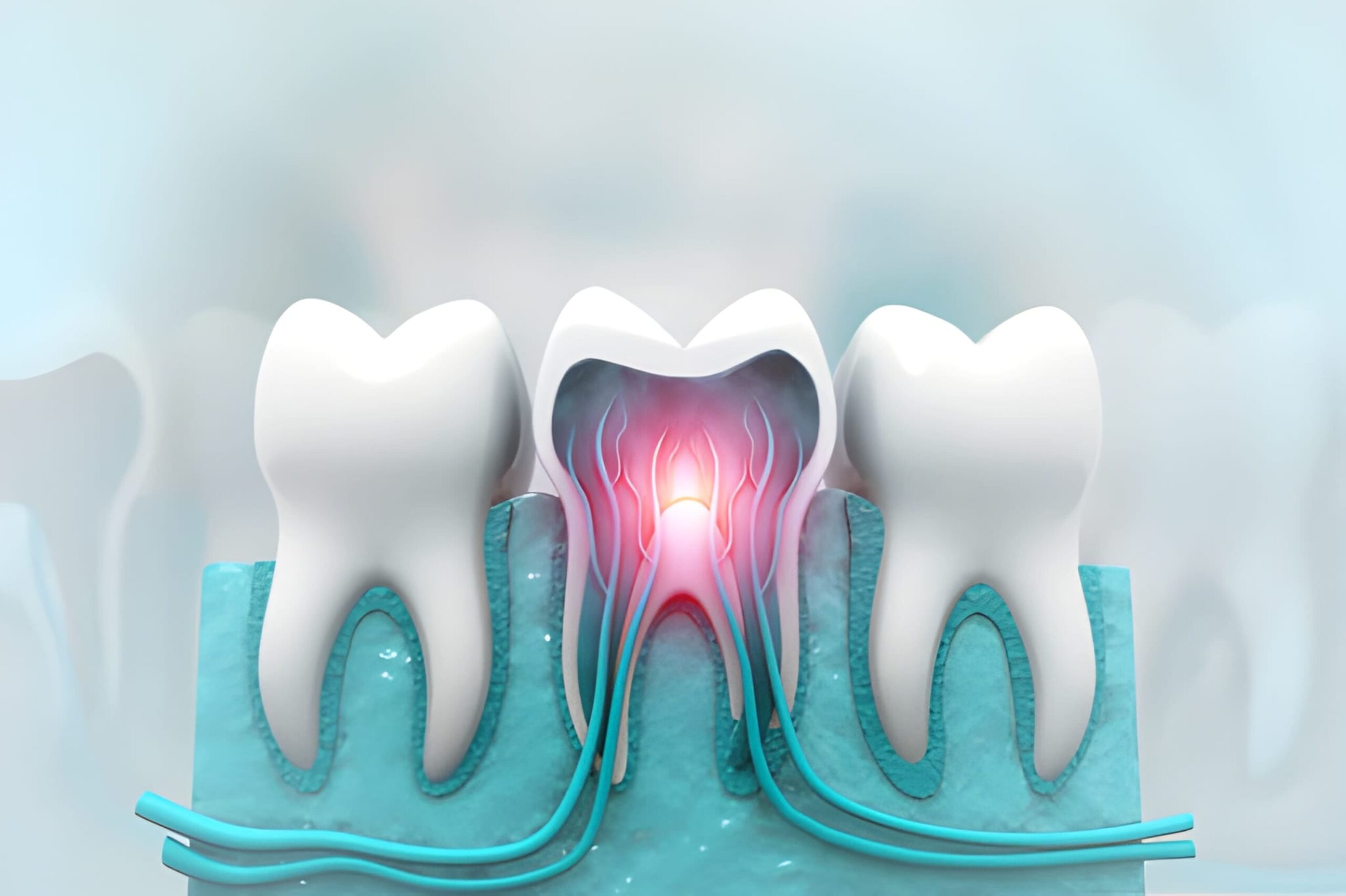 Root Canal Therapy in Sherwood Park